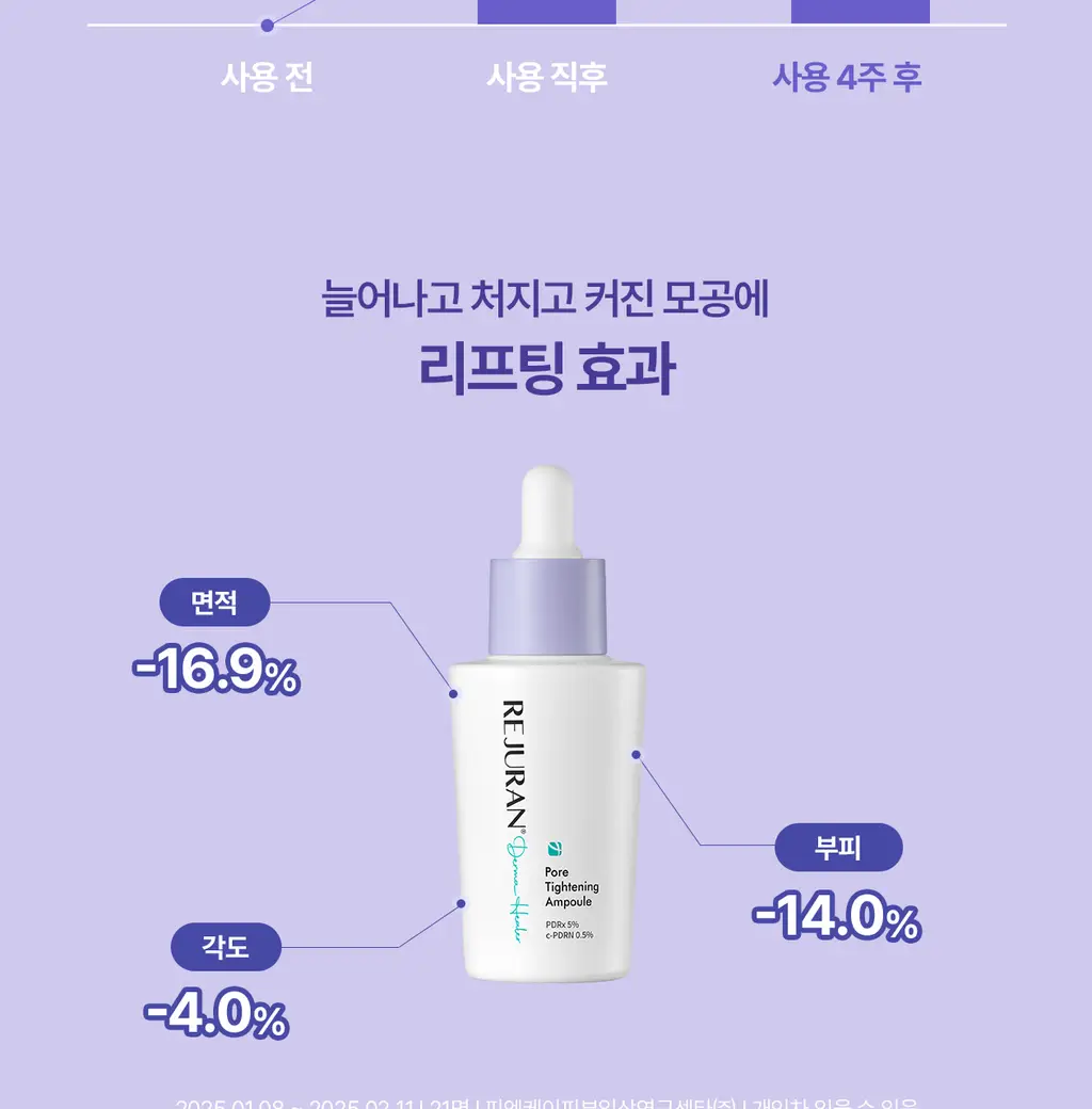 [모공PDRN/모공리프팅] 리쥬란 더마 힐러 포어 타이트닝 앰플 30ml 기획(앰플10ml+토너패드 2매*2ea) 상세페이지 29
